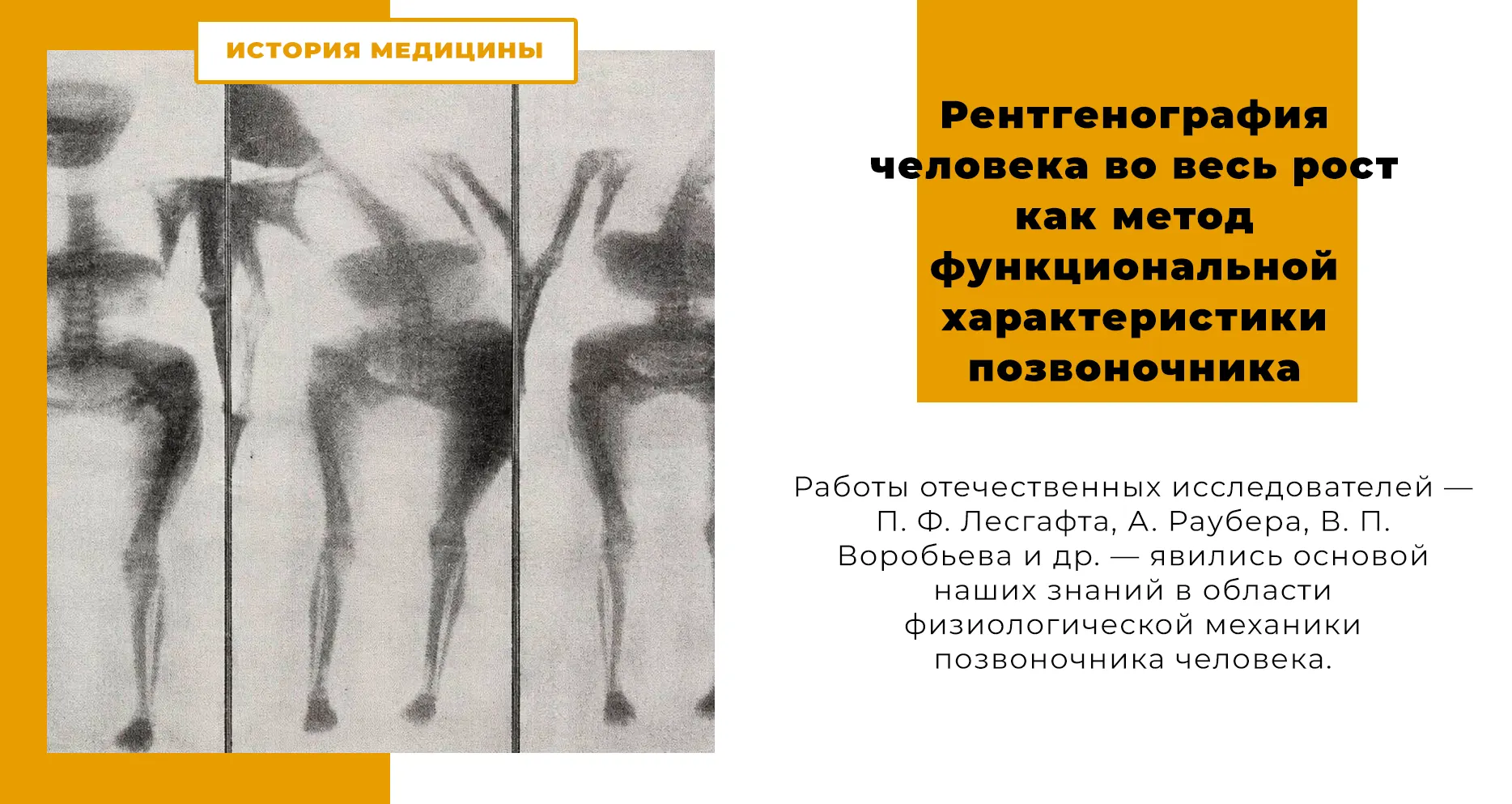Рентгенография человека во весь рост как метод функциональной характеристики позвоночника