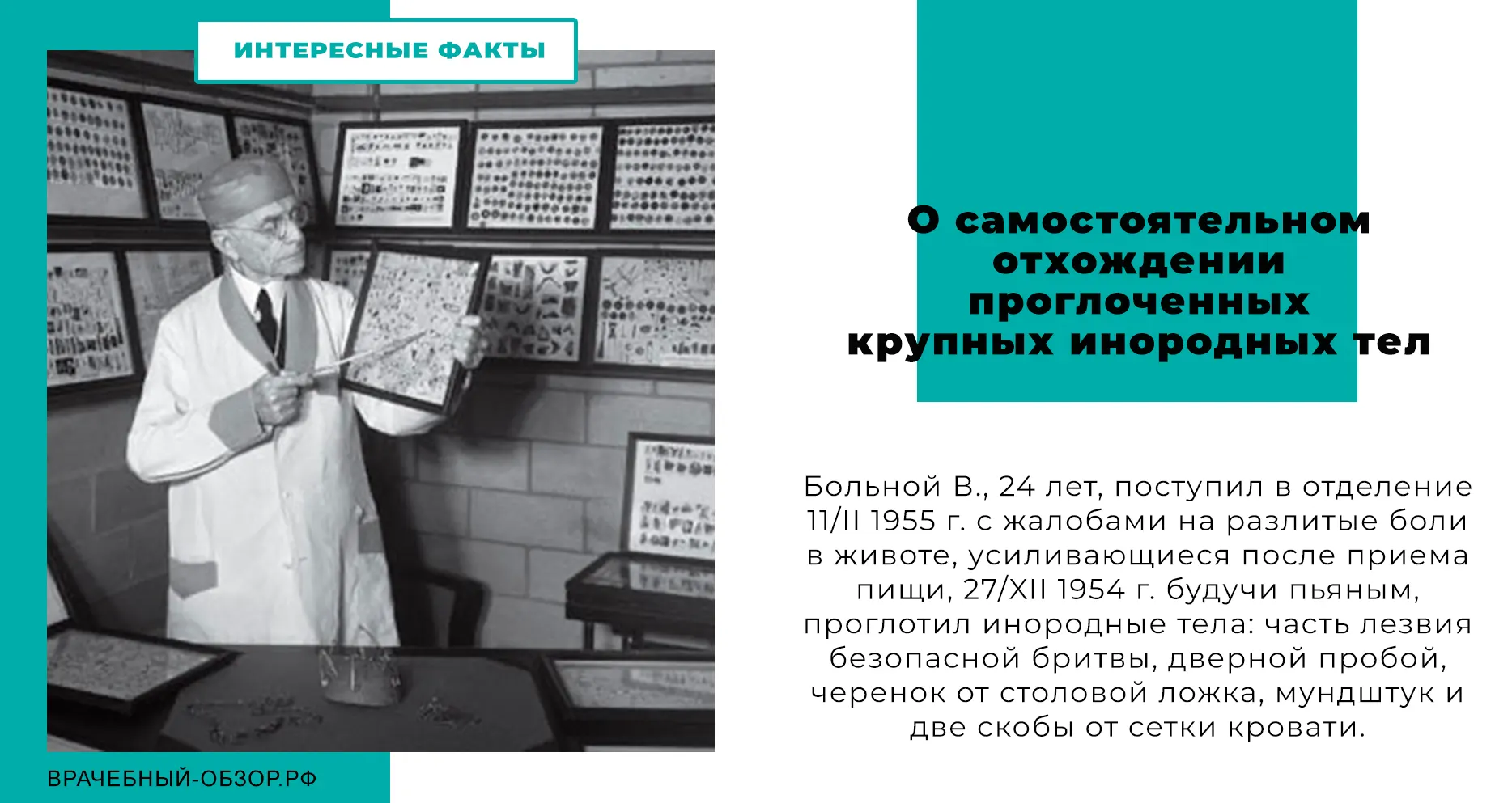 О самостоятельном отхождении проглоченных крупных инородных тел