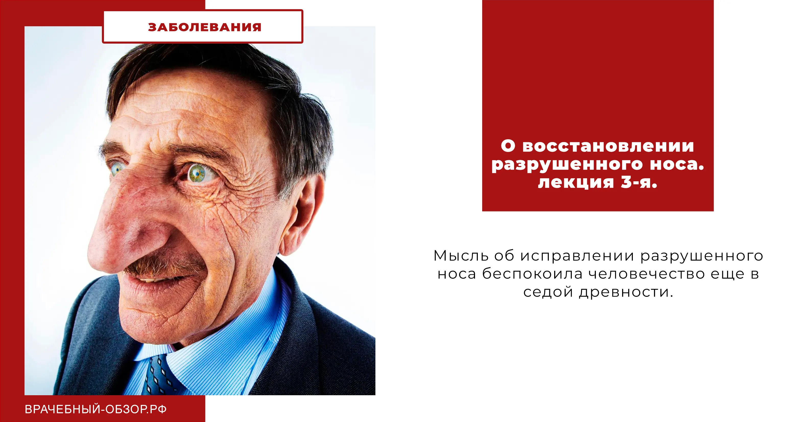О восстановлении разрушенного носа. лекция 3-я.