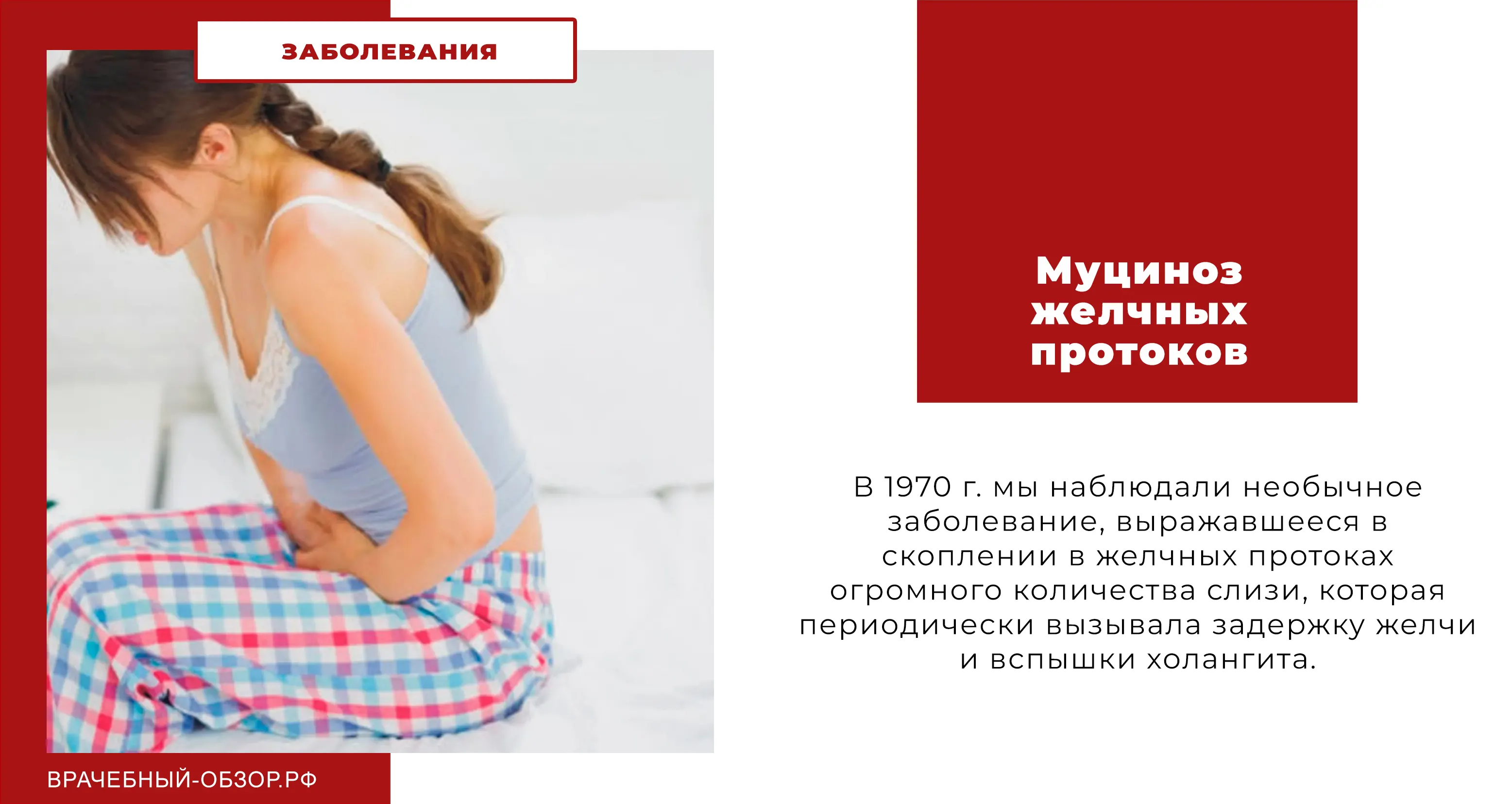 Муциноз желчных протоков