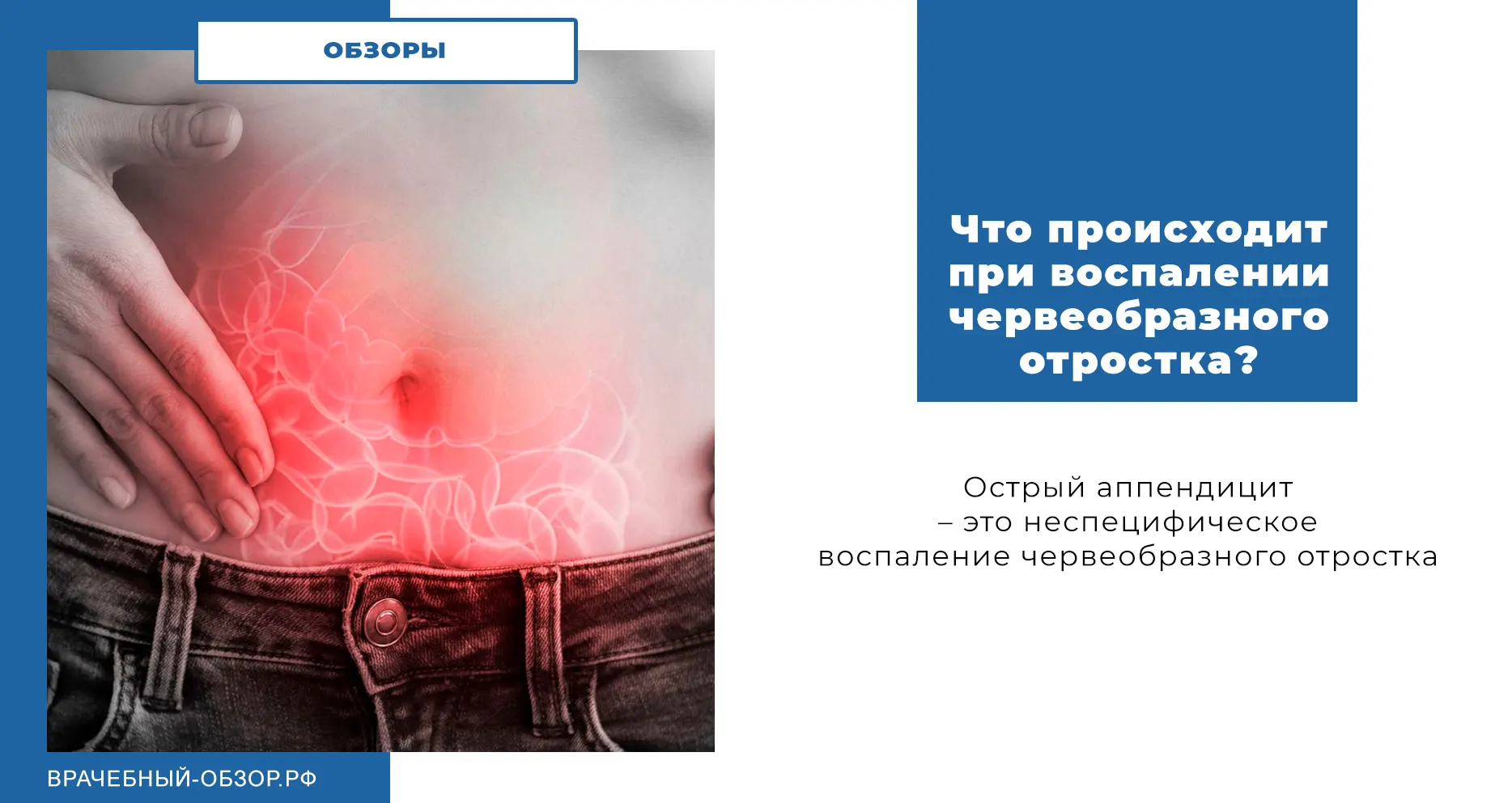 Что происходит при воспалении червеобразного отростка?