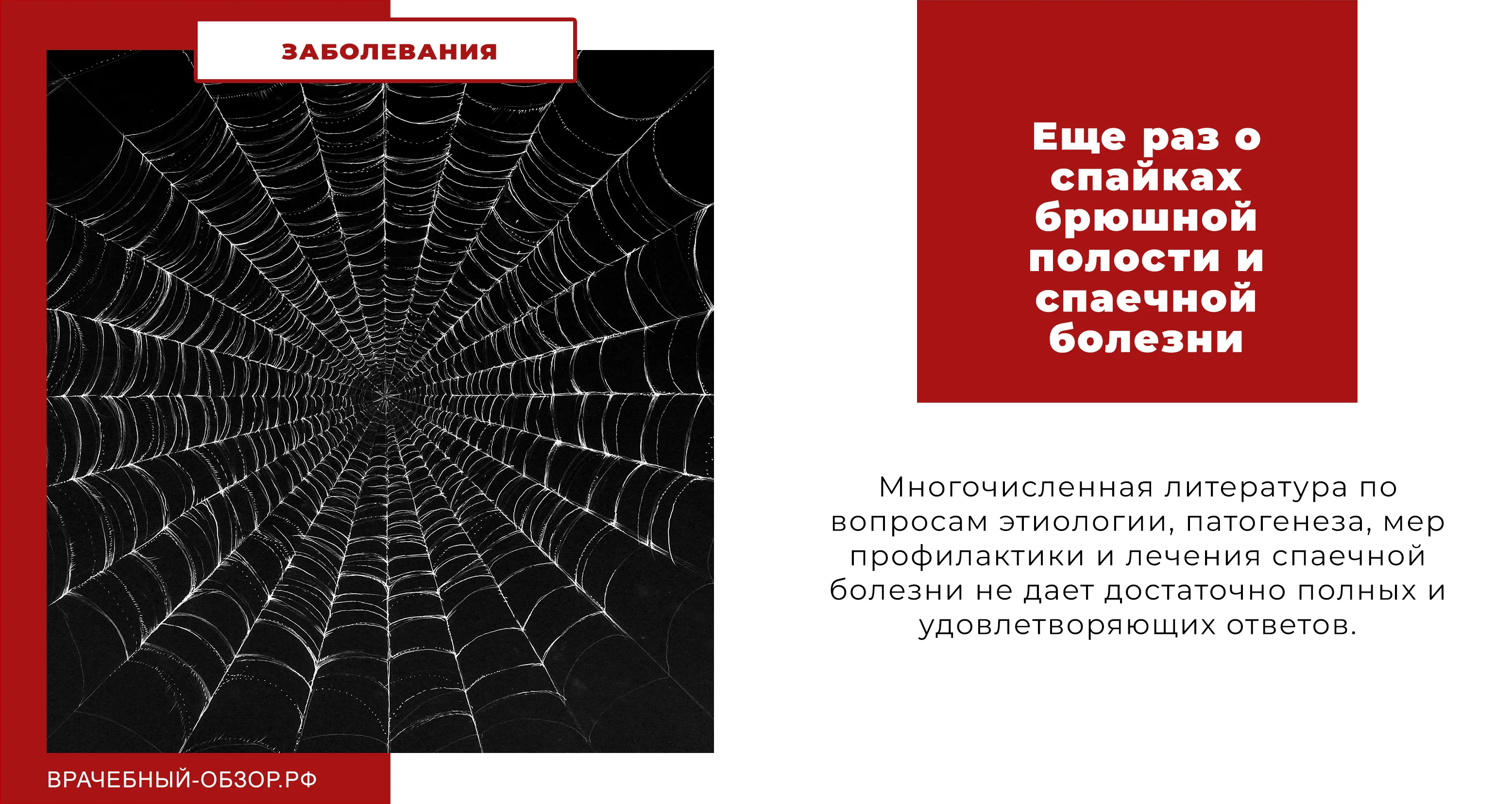 Еще раз о спайках брюшной полости и спаечной болезни