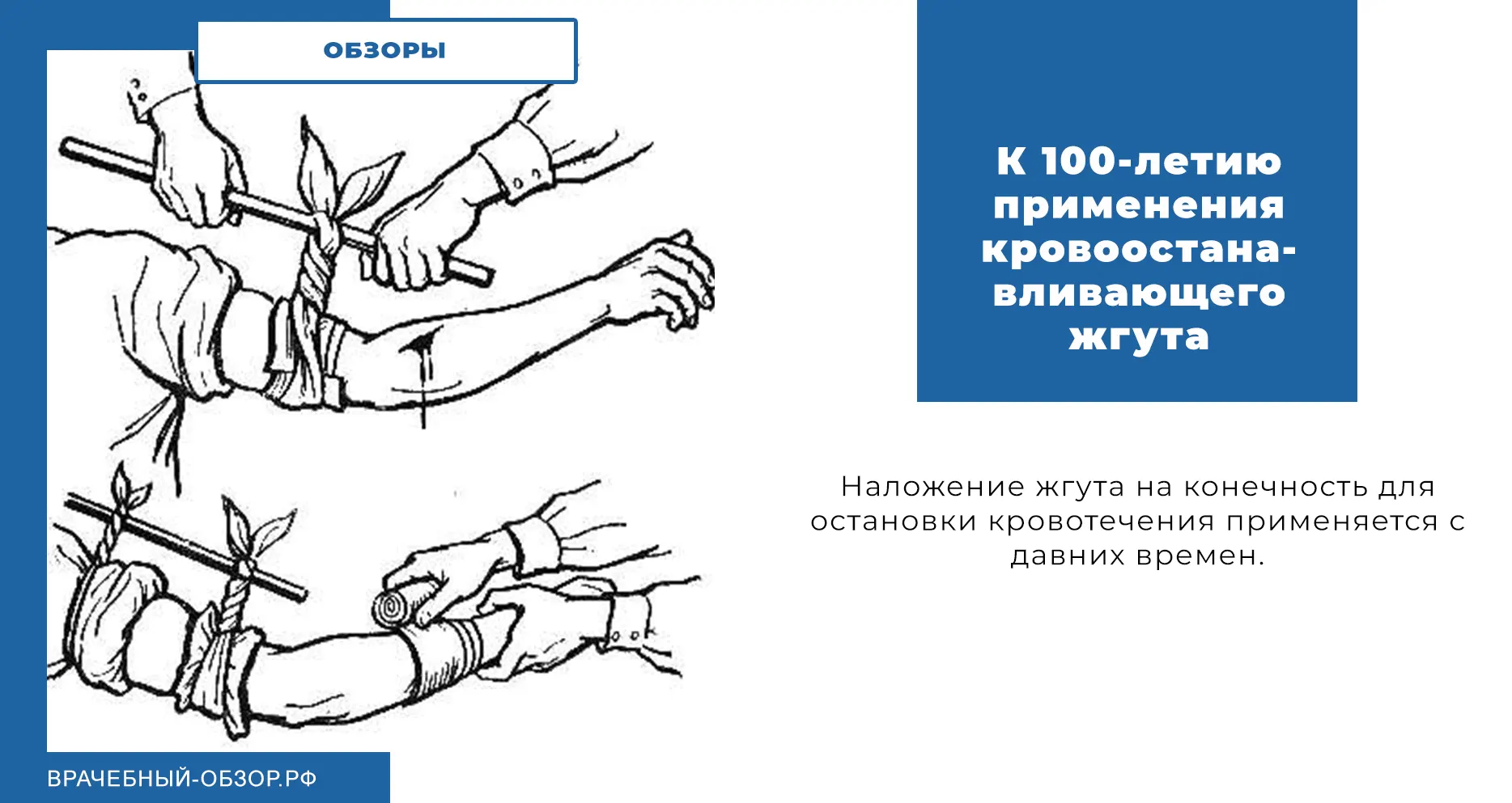 К 100-летию применения кровоостанавливающего жгута